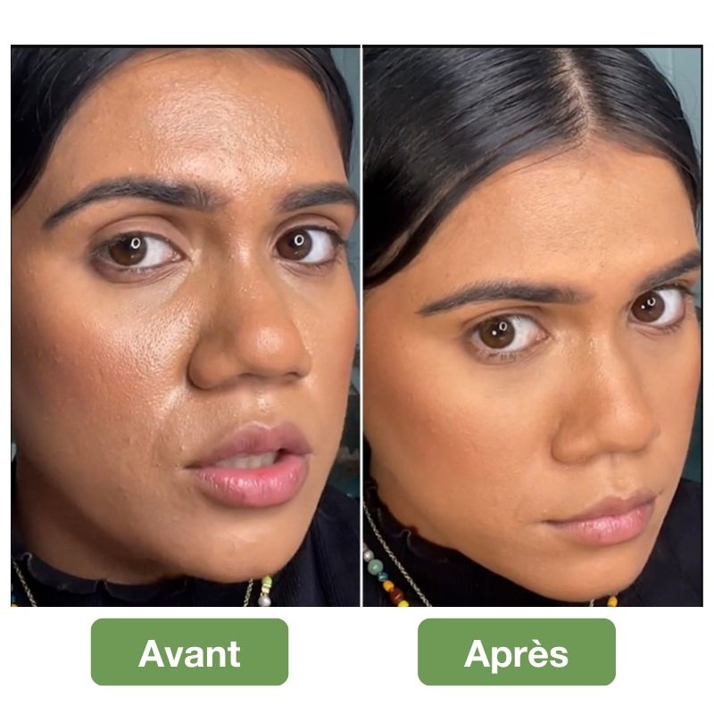 LuminaStone™ - "J'ai enfin dit adieu à la peau grasse et brillante" - Sophie, une cliente comblée
