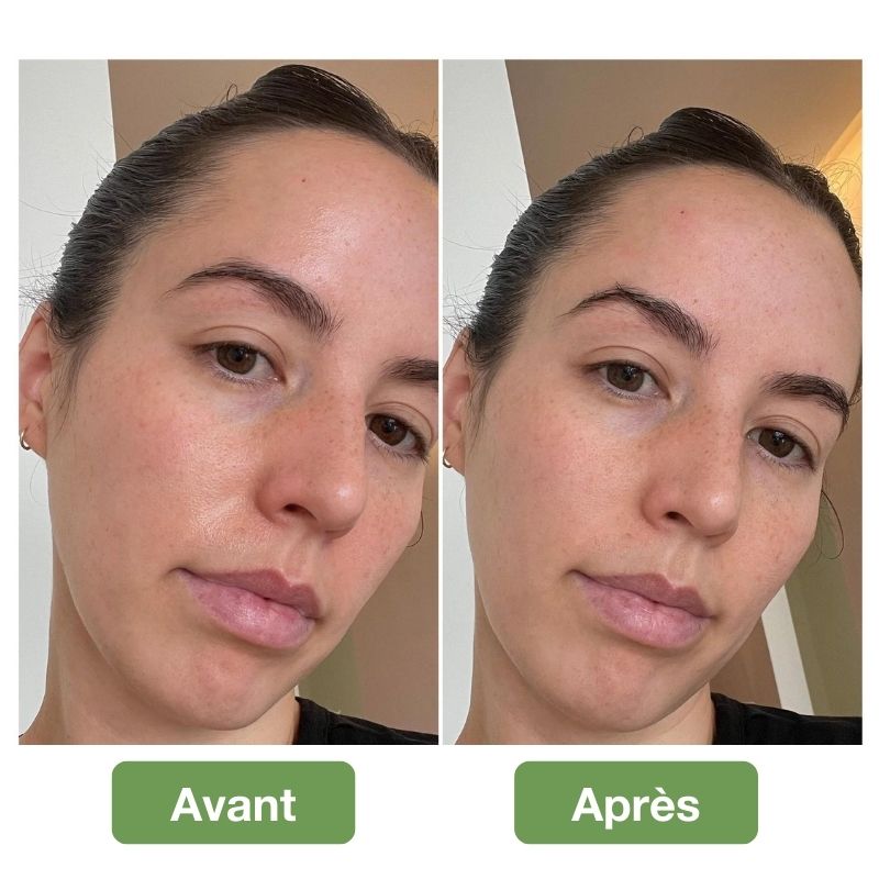 LuminaStone™ - "J'ai enfin dit adieu à la peau grasse et brillante" - Sophie, une cliente comblée