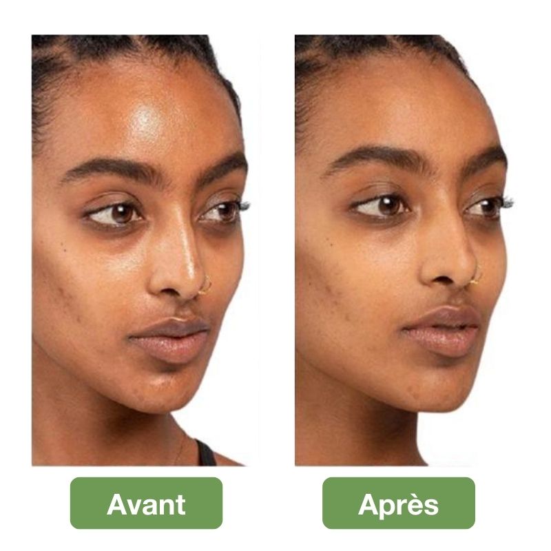 LuminaStone™ - "J'ai enfin dit adieu à la peau grasse et brillante" - Sophie, une cliente comblée